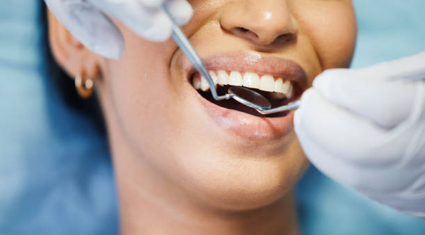 Best Emergency Dentist for Lost Fillings or Crowns in Union City, NJ