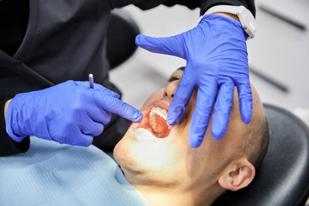 Best Emergency Dentist for Knocked-Out Tooth in Union City, NJ